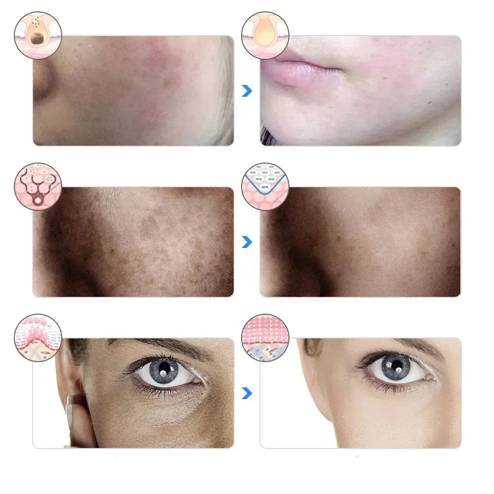 Revana Care™ Photon Light Mask (7-in-1 Modes)